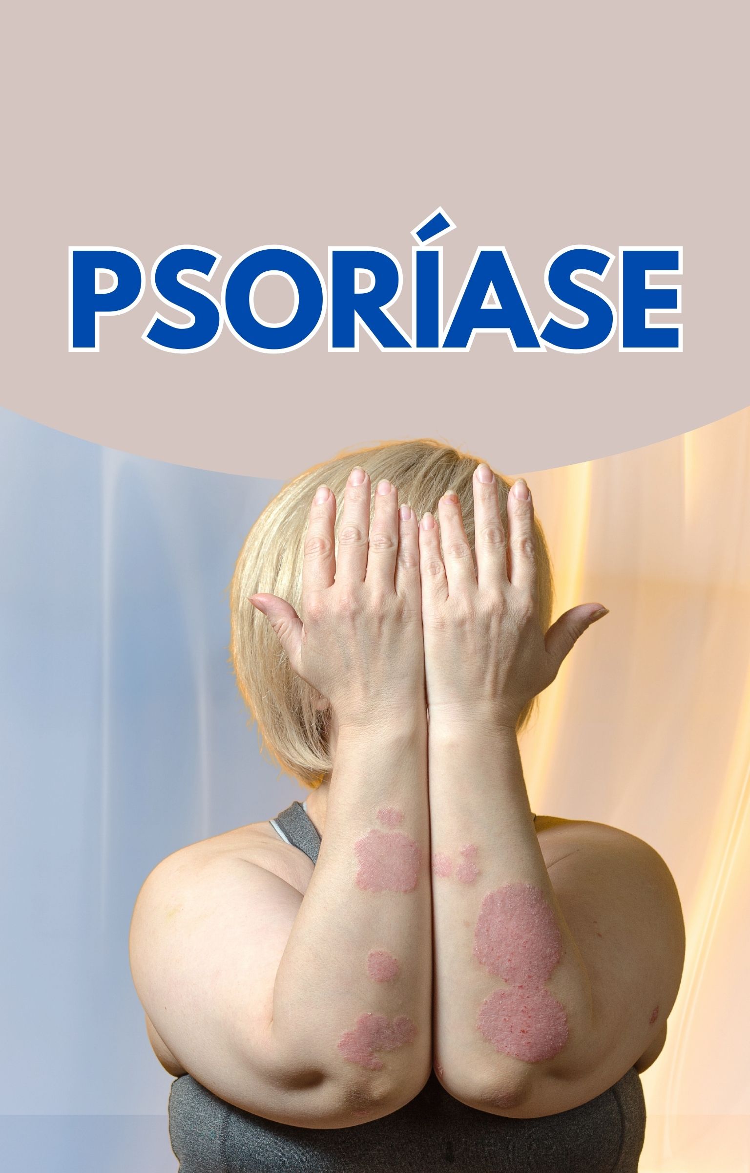 Psoríase