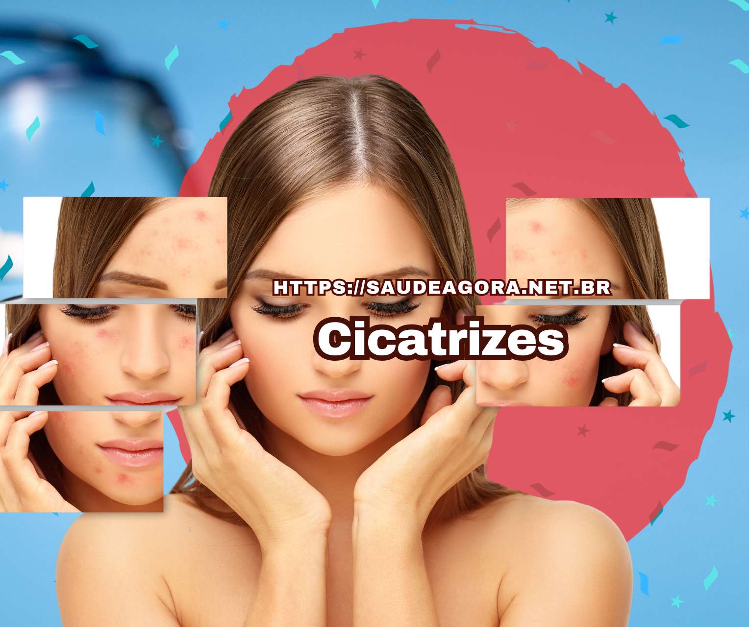 Cicatrizes